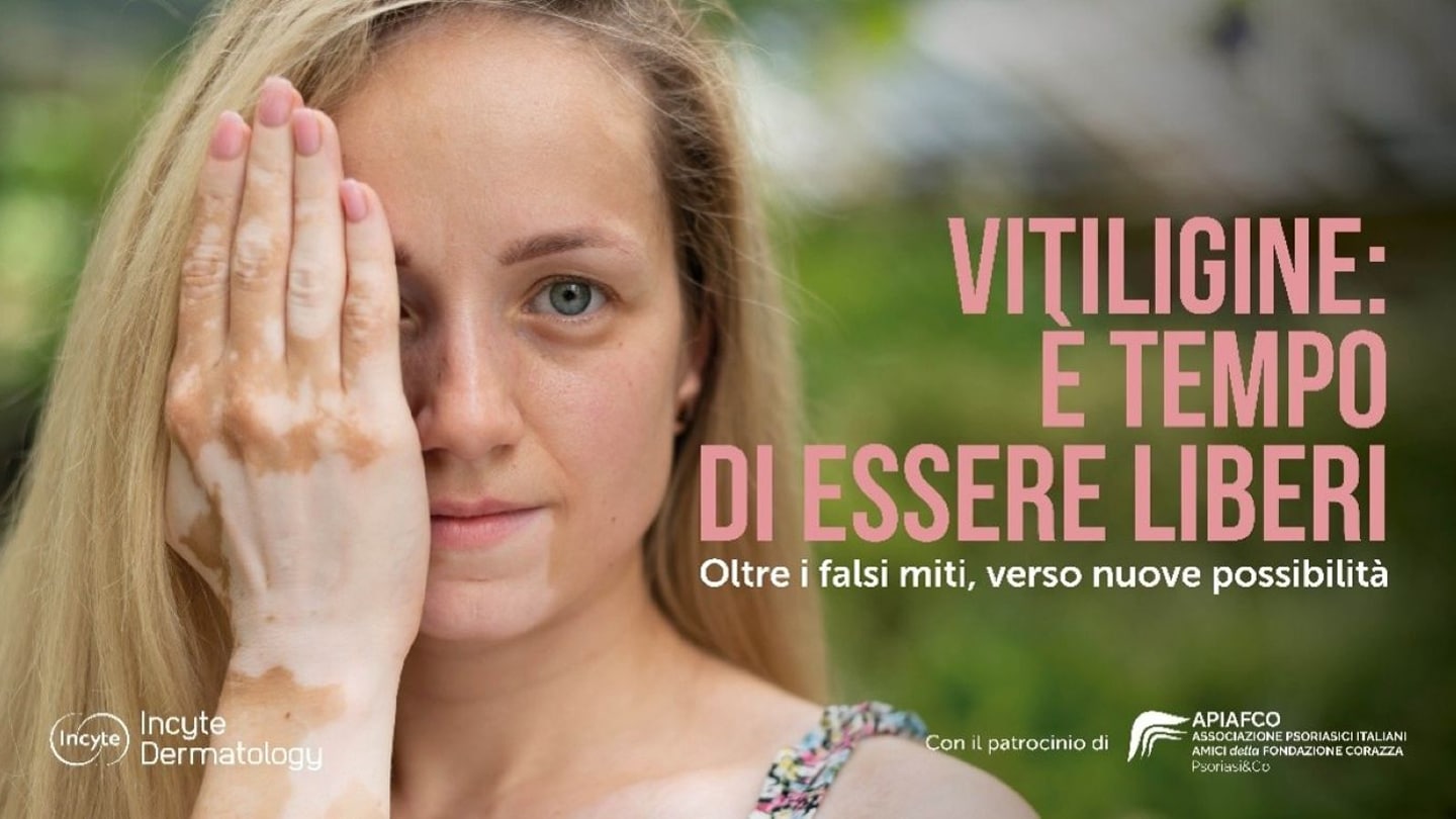 Hero Image Case Incyte Vitiligine Havas Pr 1
